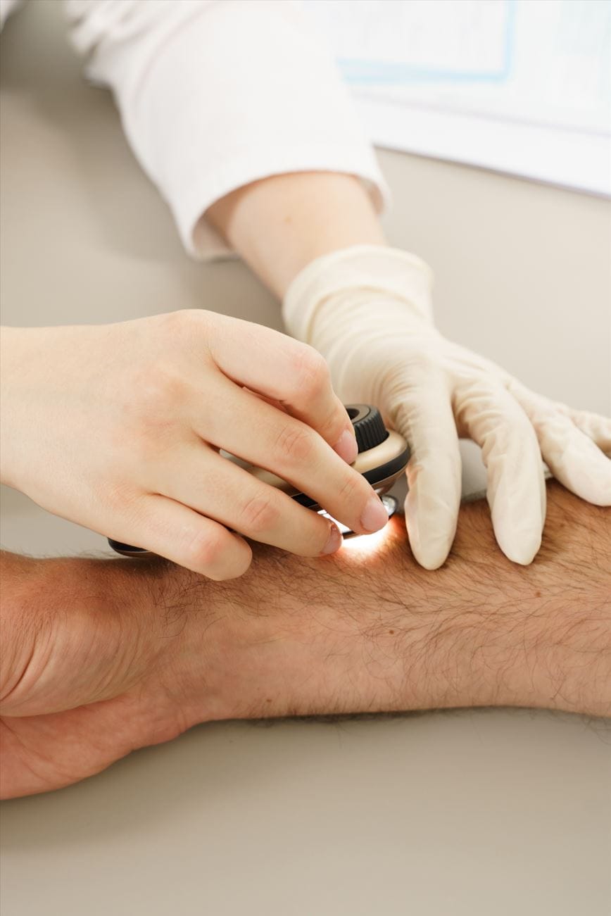 dermatoscopie skin laser clinic brasov